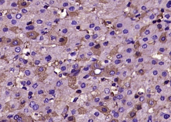 Anti-Fibrinogen Polyclonal Antibody