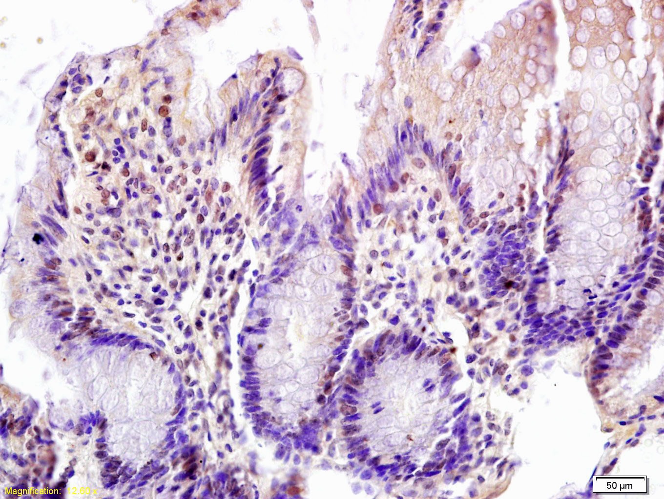 Anti-FOXN1 Polyclonal Antibody