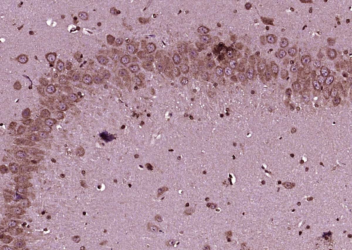 Anti-GLS1 Polyclonal Antibody