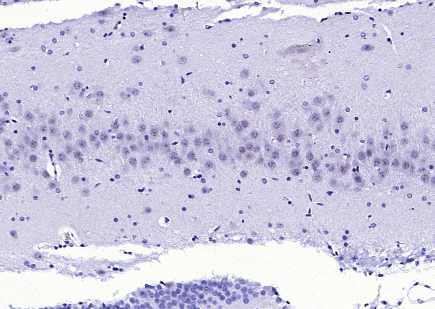 Anti-FGFR1 Polyclonal Antibody