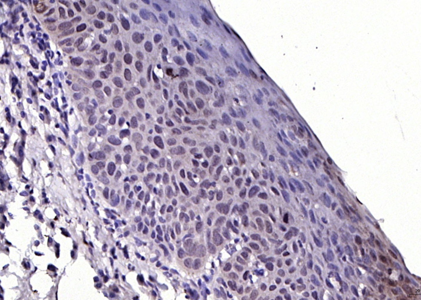 Anti-FGFR1 Polyclonal Antibody