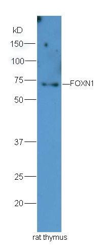 Anti-FOXN1 Polyclonal Antibody