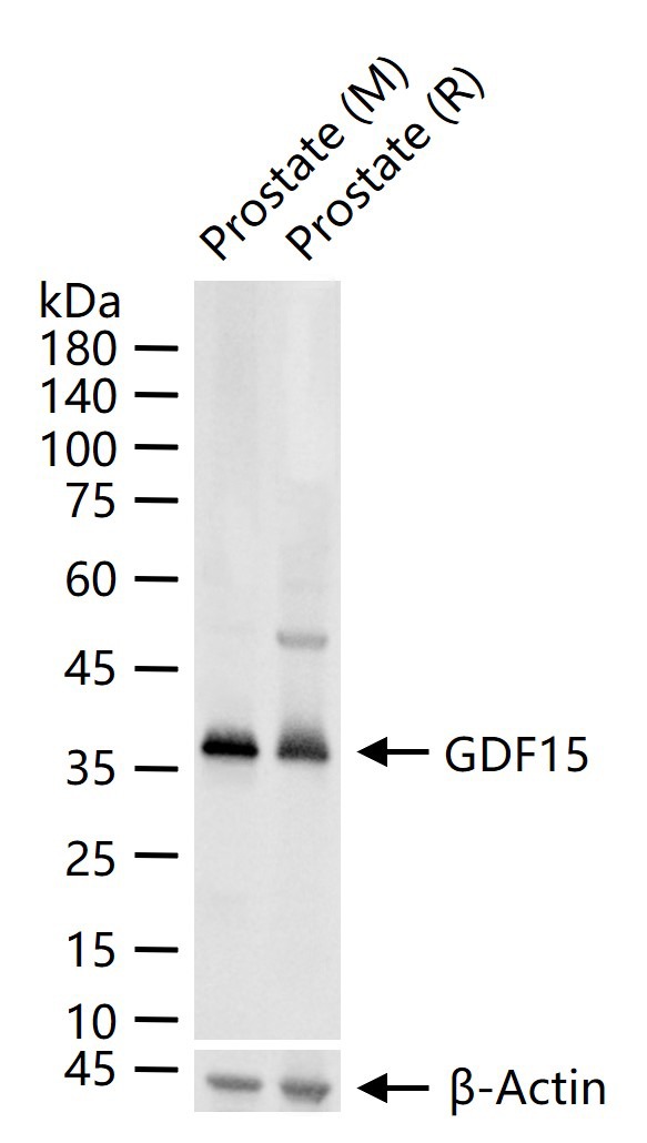 Anti-GDF-15 Polyclonal Antibody