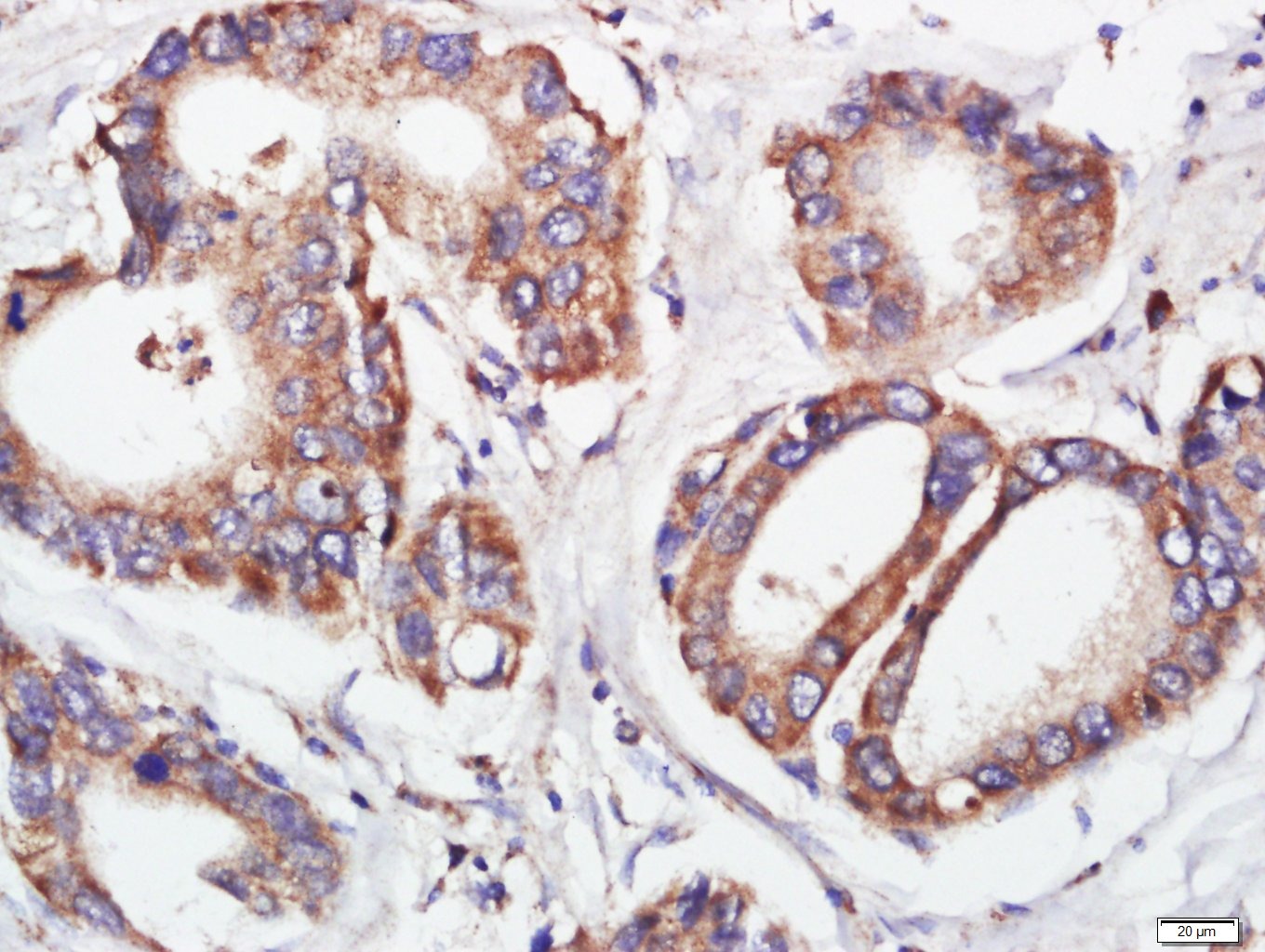 Anti-FGFR2 Polyclonal Antibody