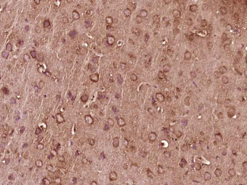 Anti-G-CSF Polyclonal Antibody