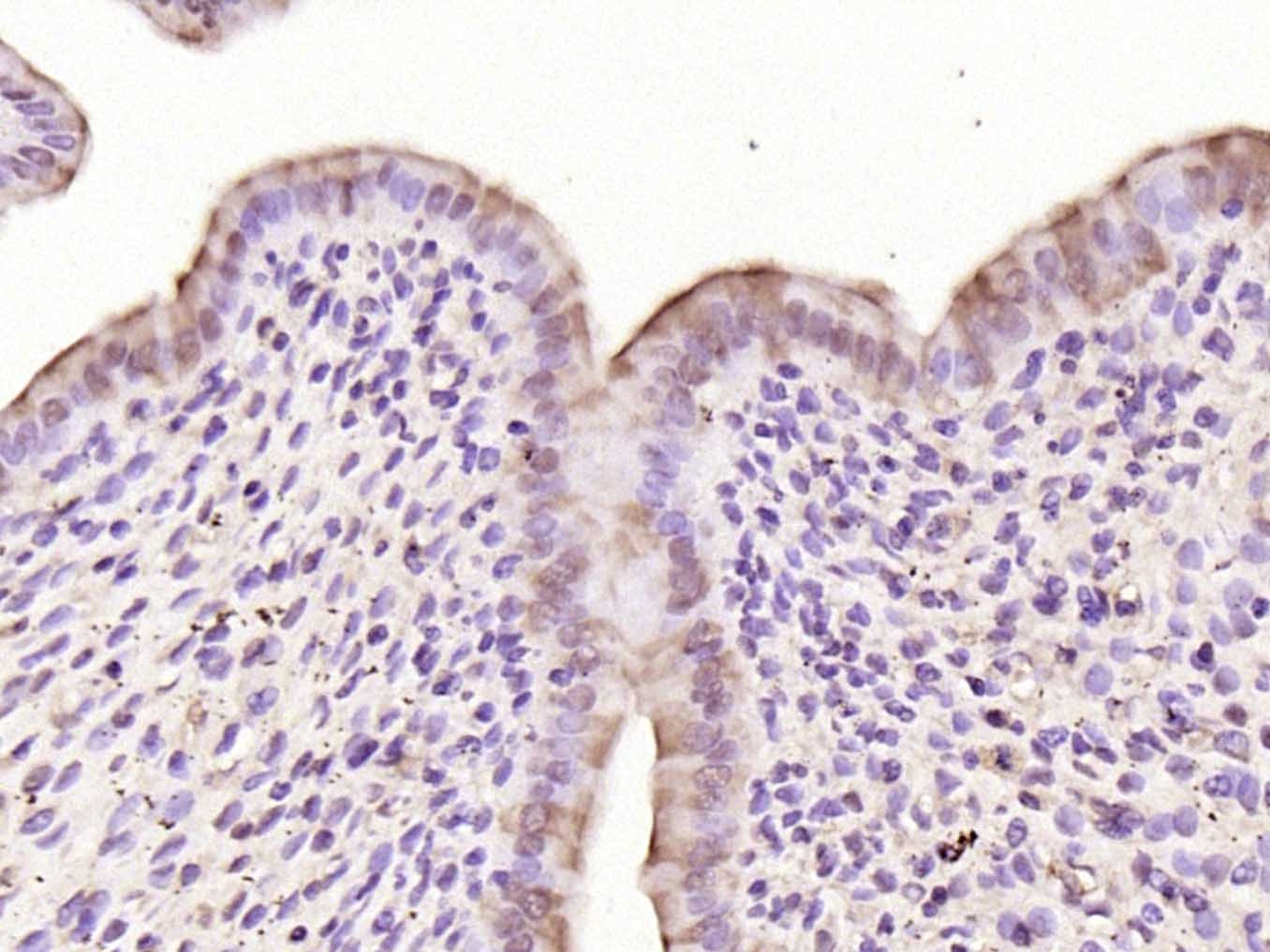 Anti-FOS Polyclonal Antibody 3