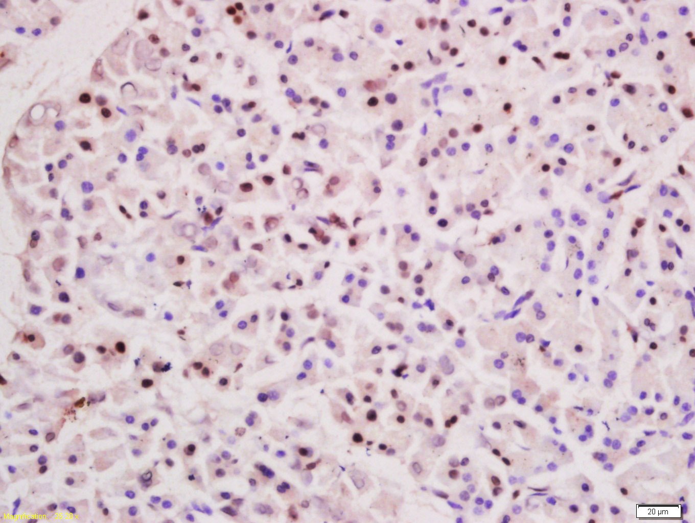Anti-FOXO1 Polyclonal Antibody