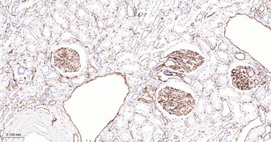 Anti-CD31 Antibody (2K688)