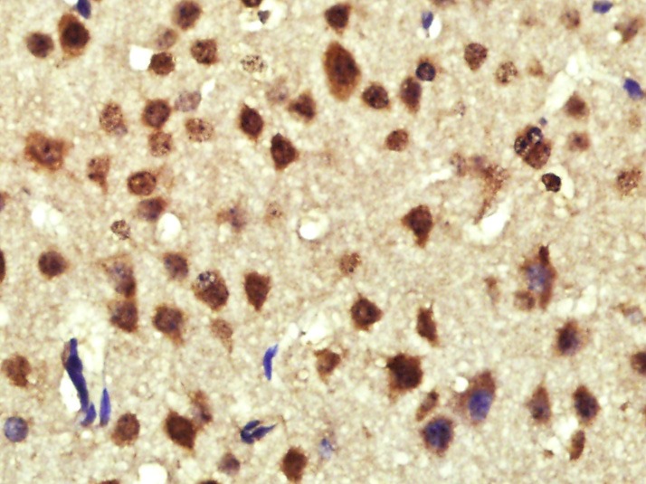 Anti-CCND1 Polyclonal Antibody 2