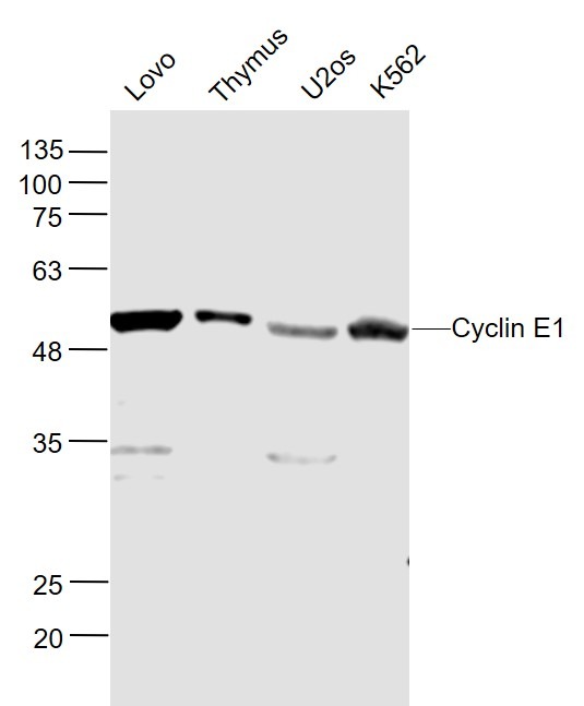 Anti-CCNE1 Polyclonal Antibody