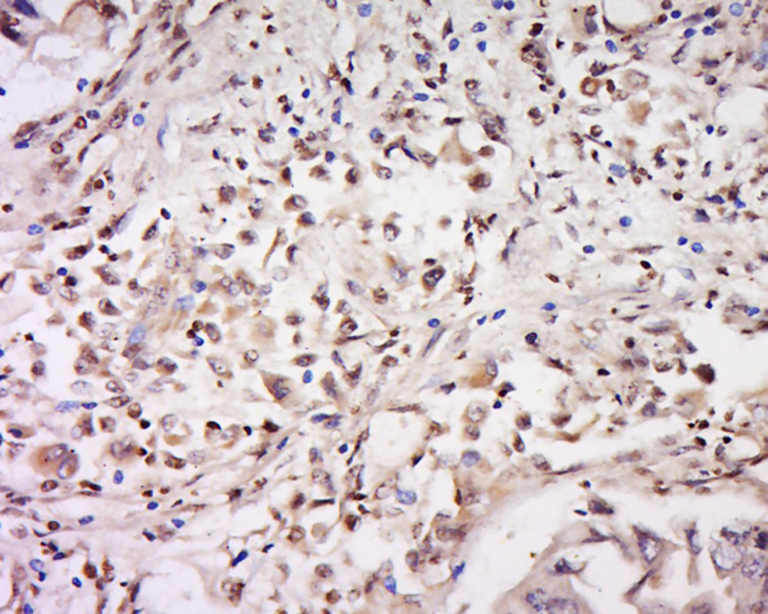 Anti-CD93 Polyclonal Antibody