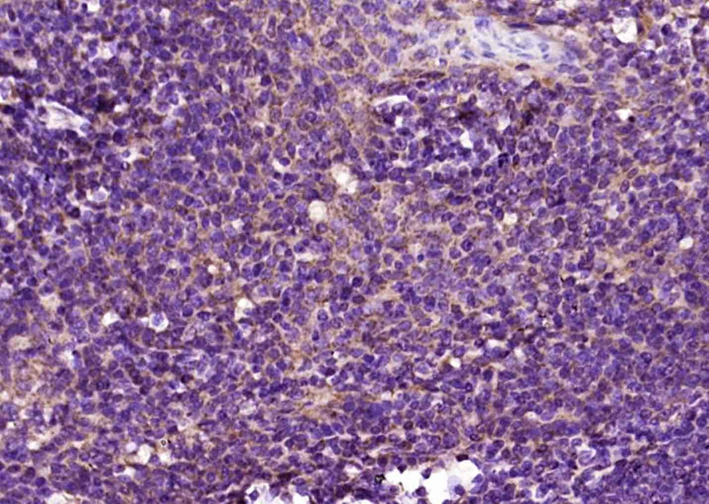 Anti-CD4 Polyclonal Antibody