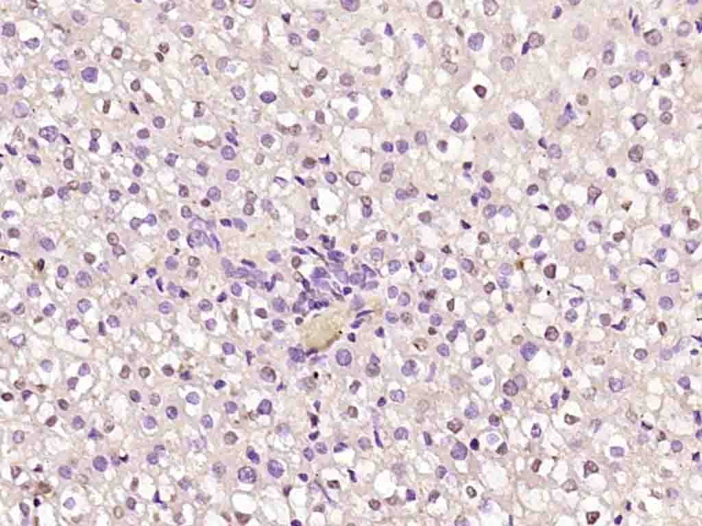 Anti-CCND1 Polyclonal Antibody 2