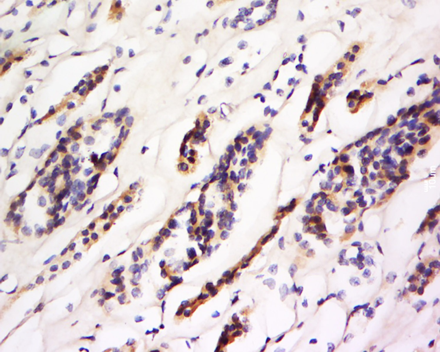 Anti-CD93 Polyclonal Antibody
