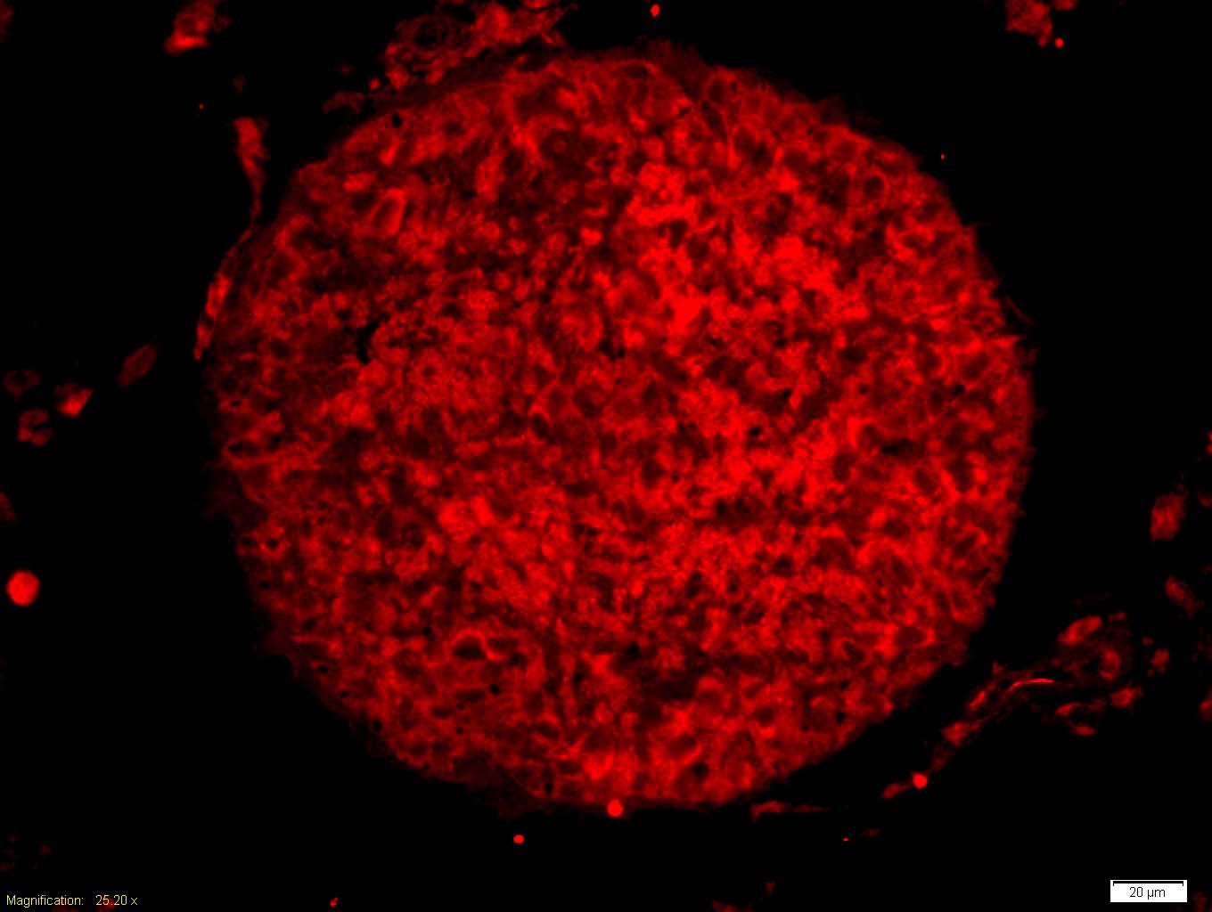 Anti-CCNE1 Polyclonal Antibody