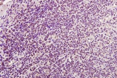 Anti-CD4 Polyclonal Antibody