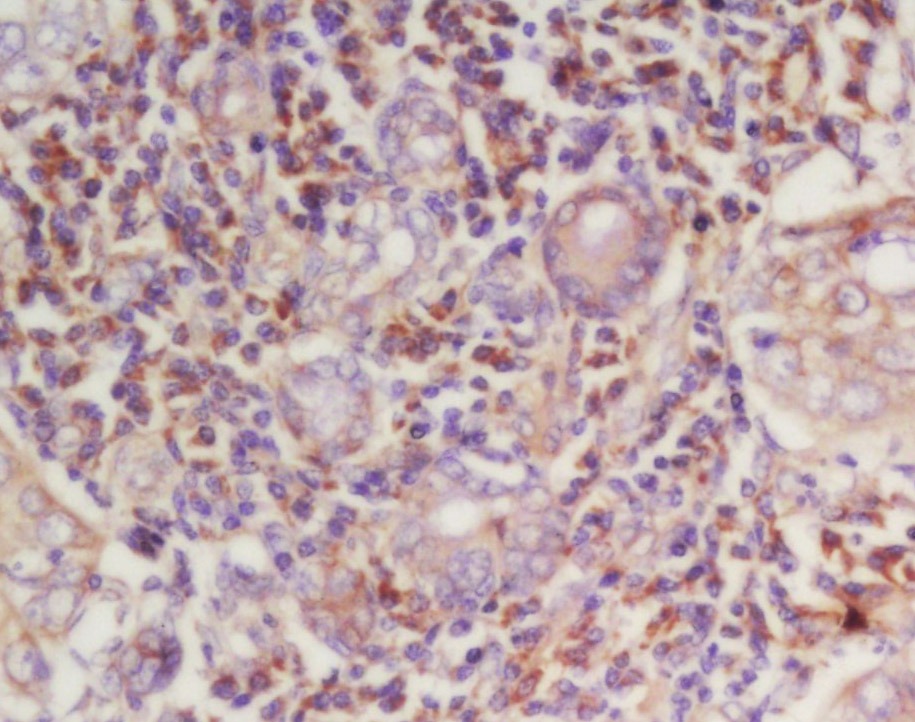 Anti-CCNE1 Polyclonal Antibody