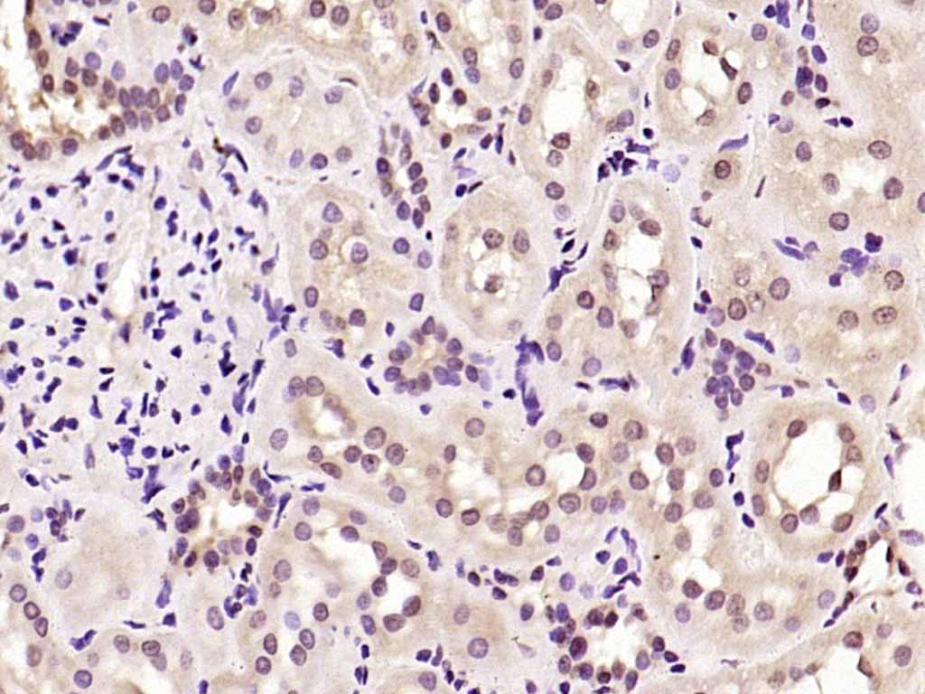 Anti-CCND1 Polyclonal Antibody 2