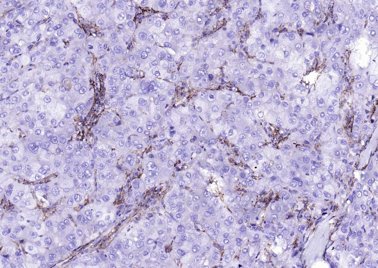 Anti-CD14 Polyclonal Antibody