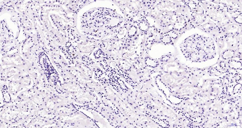 Anti-CD45 Polyclonal Antibody