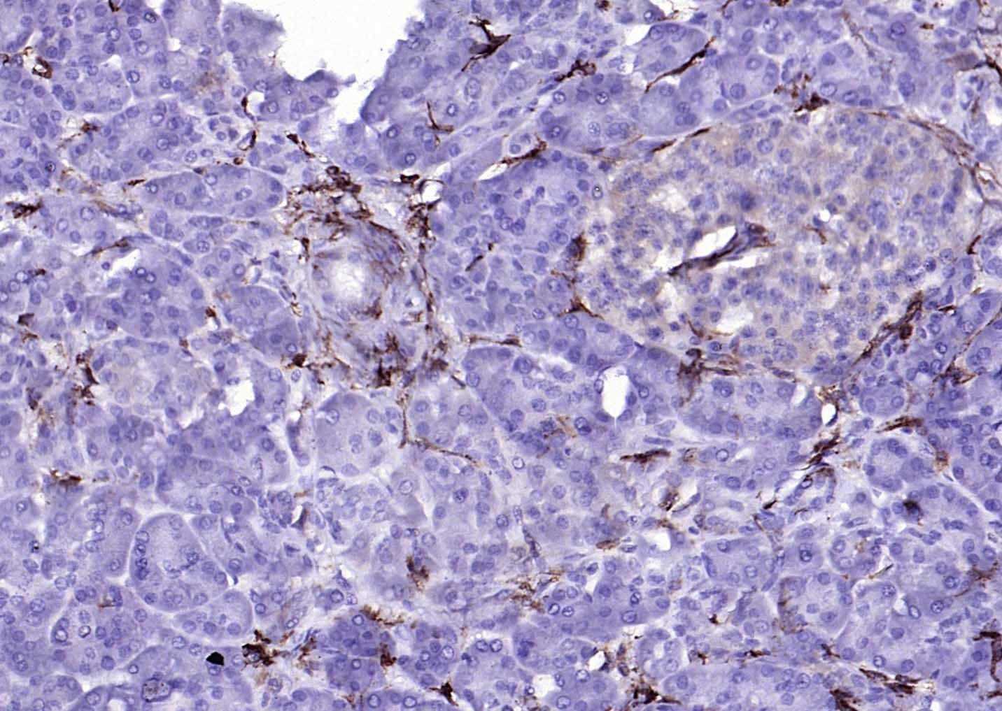 Anti-CD14 Polyclonal Antibody