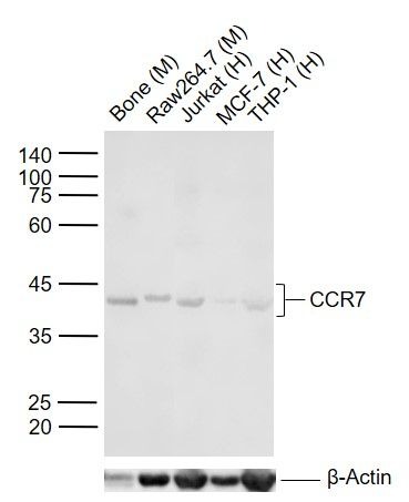 Anti-CCR7 Polyclonal Antibody