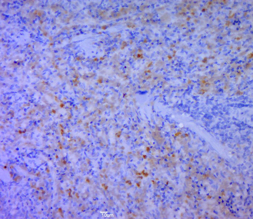 Anti-CD5L Polyclonal Antibody