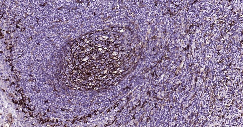 Anti-CD14 Antibody (2E832)