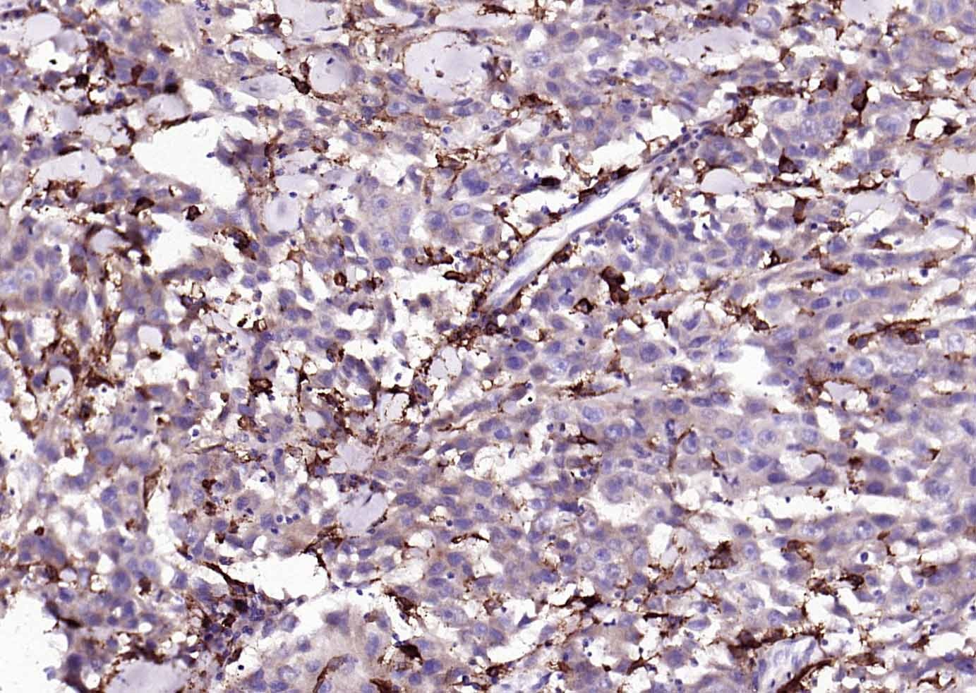 Anti-CD14 Antibody (2E832)