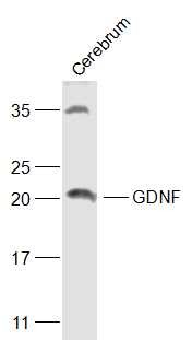 Anti-GDNF Polyclonal Antibody 2