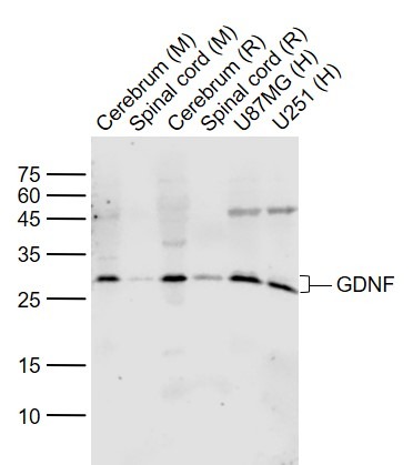 Anti-GDNF Polyclonal Antibody