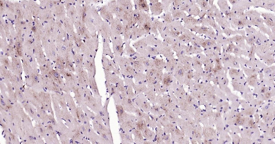 Anti-GJA5 Polyclonal Antibody