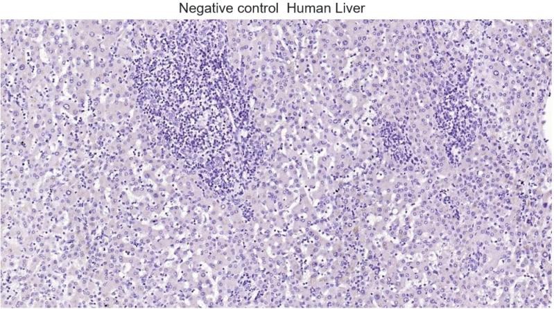 Anti-GFAP Antibody (3A643)