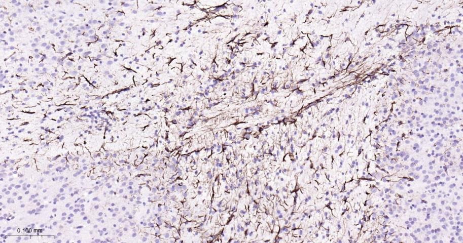 Anti-GFAP Polyclonal Antibody