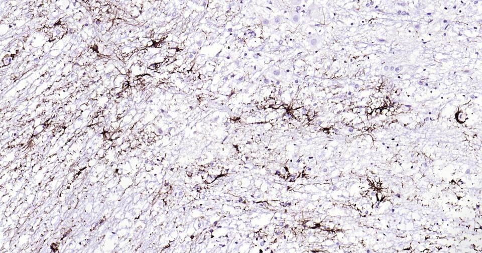 Anti-GFAP Antibody (3A643)