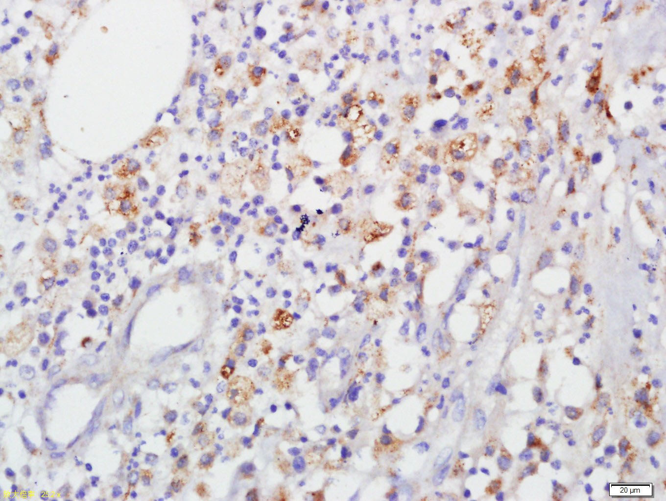 Anti-GJA1 Polyclonal Antibody 2