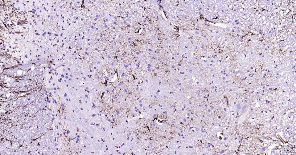 Anti-GFAP Antibody (3A643)