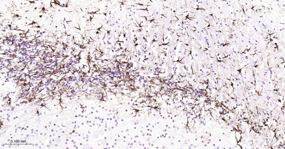 Anti-GFAP Polyclonal Antibody