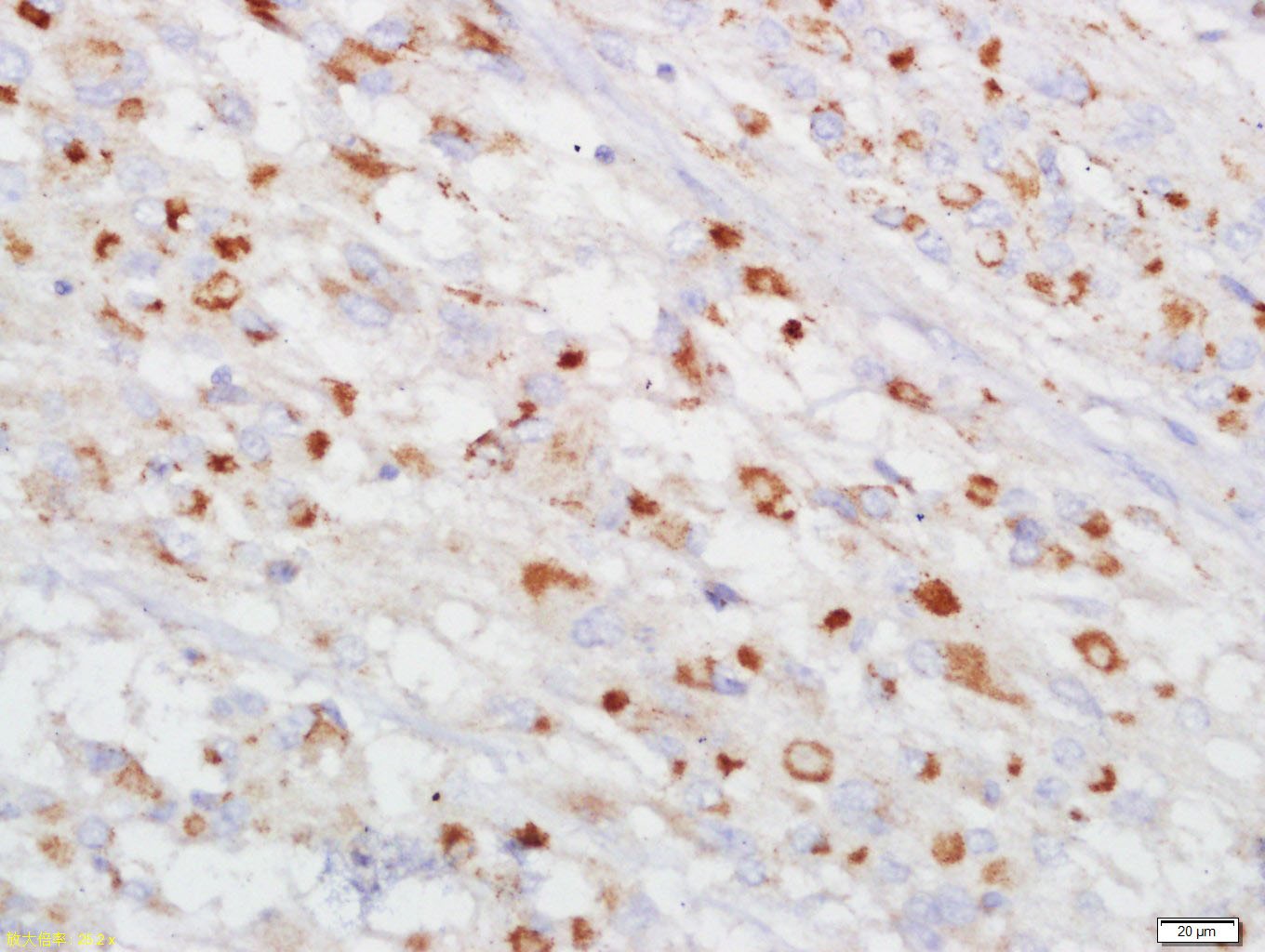 Anti-GJA1 Polyclonal Antibody 2