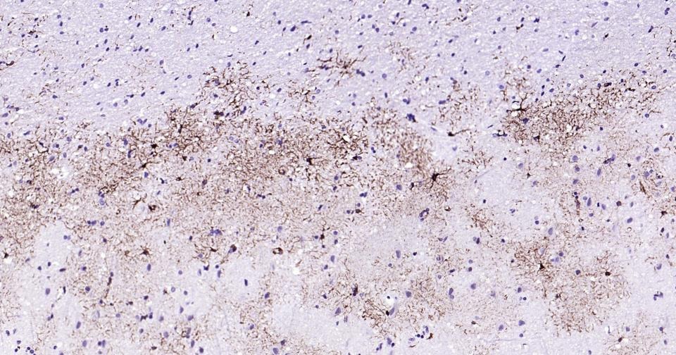 Anti-GFAP Antibody (3A643)