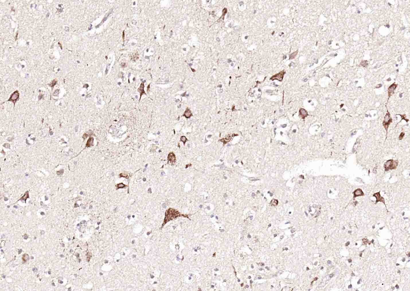 Anti-GFR Alpha-1/GFRA1 Polyclonal Antibody