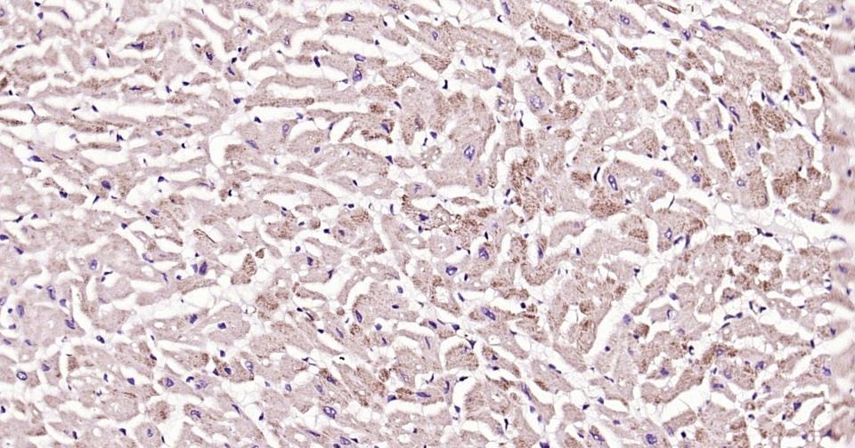 Anti-GJA5 Polyclonal Antibody
