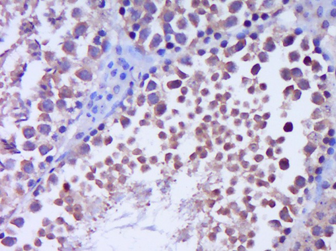 Anti-GLI1 Polyclonal Antibody