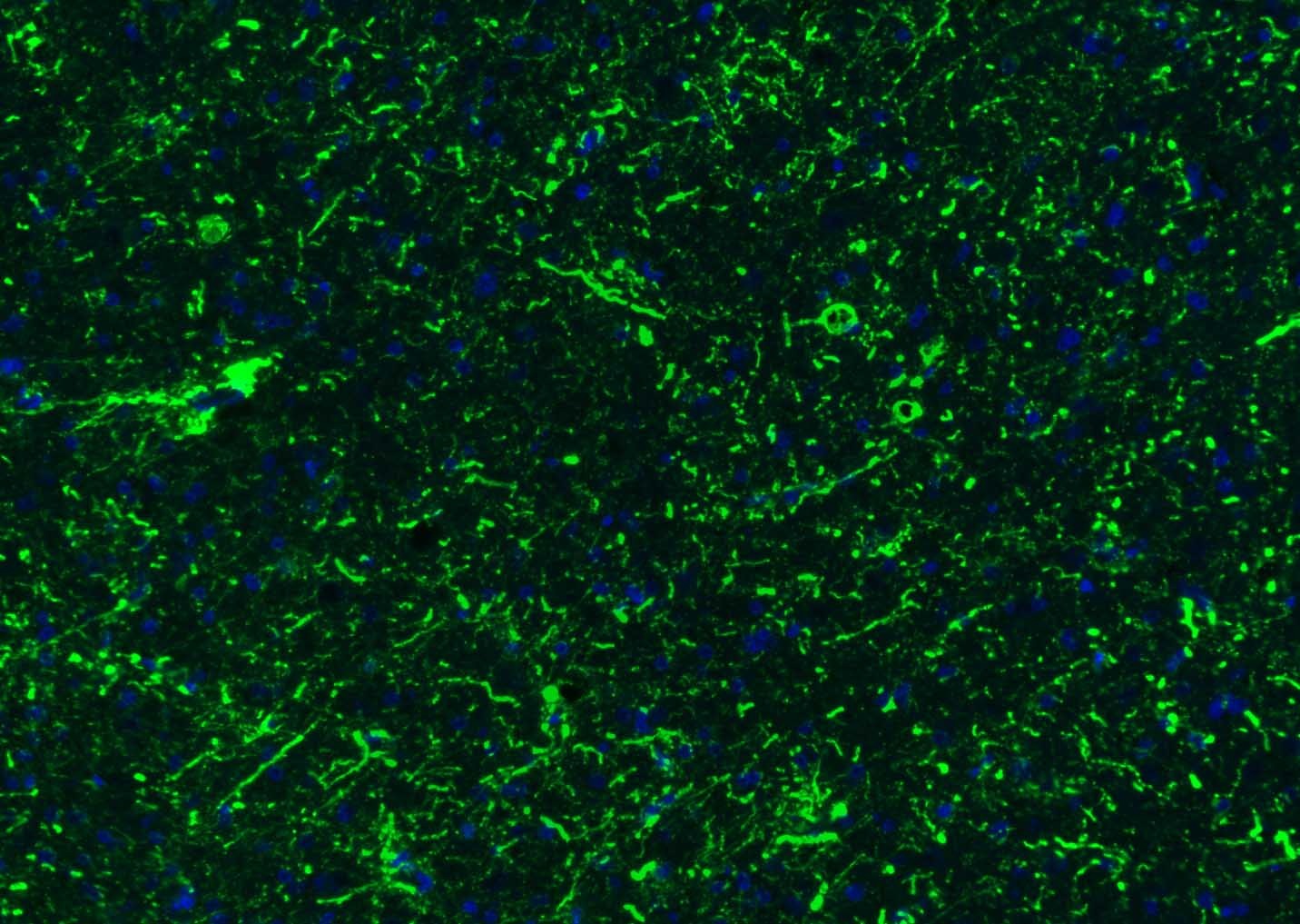 Anti-GFAP Polyclonal Antibody