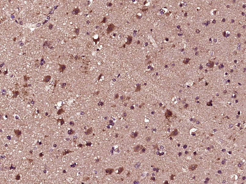 Anti-GLI1 Polyclonal Antibody