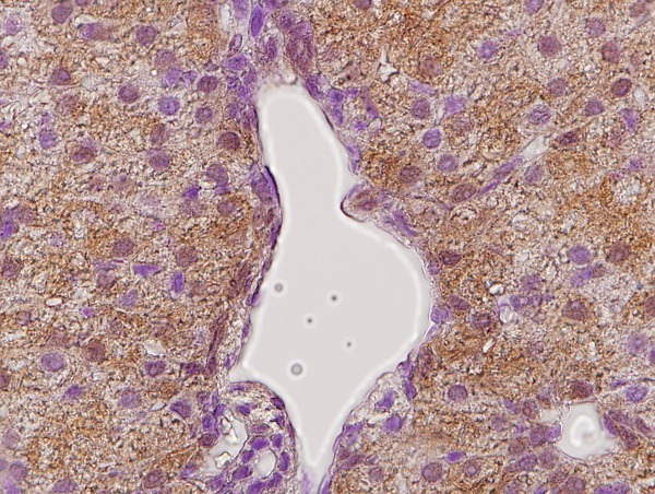 Anti-GHR/Growth Hormone R Polyclonal Antibody