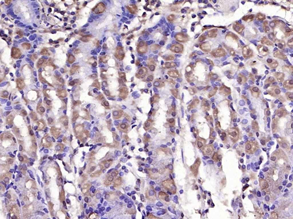 Anti-GLI1 Polyclonal Antibody