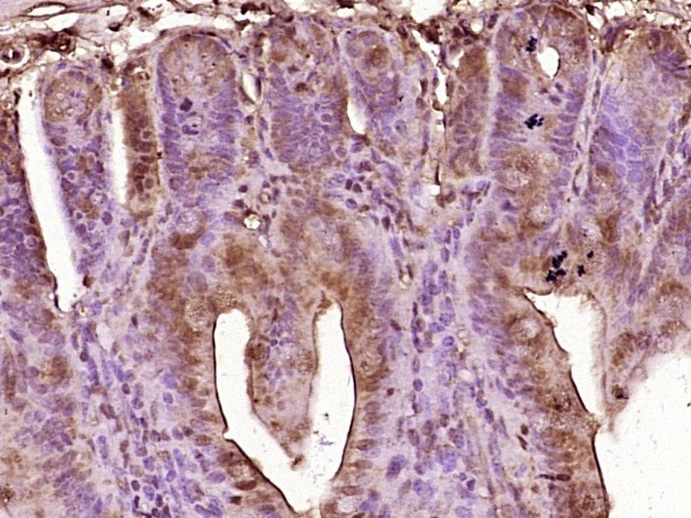 Anti-GIP Polyclonal Antibody