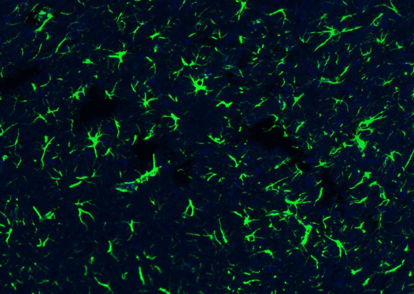 Anti-GFAP Polyclonal Antibody