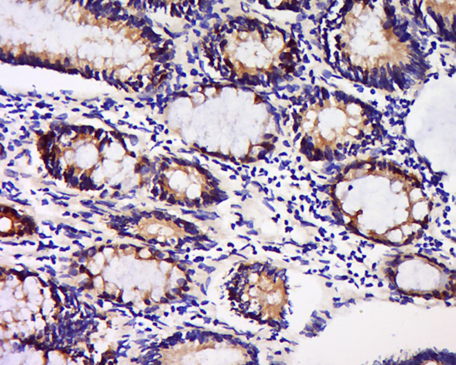 Anti-GFR Alpha-1/GFRA1 Polyclonal Antibody
